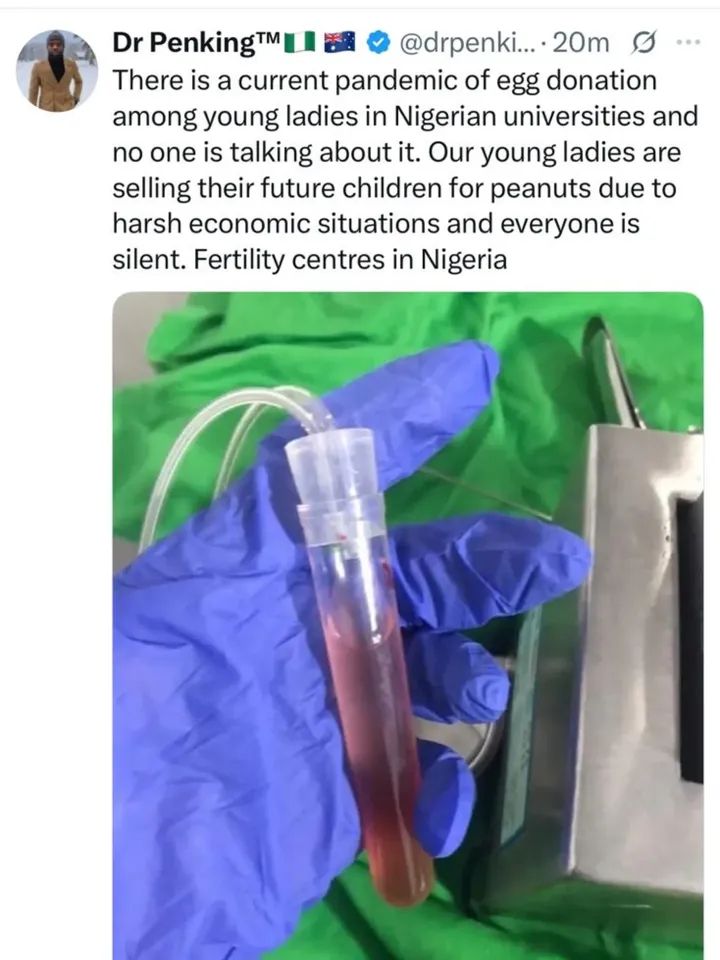Nigerian female students selling their eggs to cope with hardship – Doctor raises alarm  